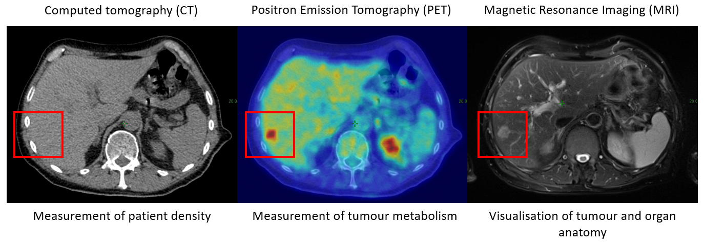 Figure 1 &\#8211; Multimodality Imaging | Better Healthcare Technology ...